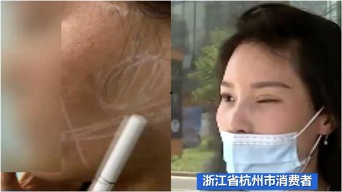 央视爆料医美打针视频大全,央视曝光视频大全